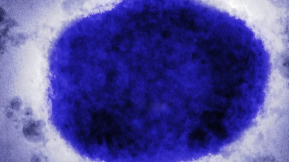 monkeypox-virus-GettyImages-758292709-a59c85adaca04a6c9d84b792274d12e8.jpg