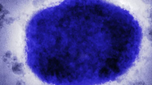 monkeypox-virus-GettyImages-758292709-a59c85adaca04a6c9d84b792274d12e8.jpg